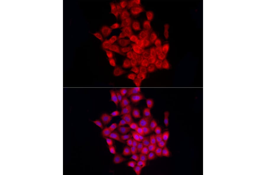 Immunofluorescence - Anti-beta 2 Adrenergic Receptor Antibody (A11507) - Antibodies.com