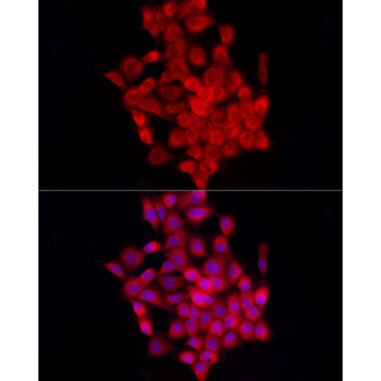 Immunofluorescence - Anti-beta 2 Adrenergic Receptor Antibody (A11507) - Antibodies.com