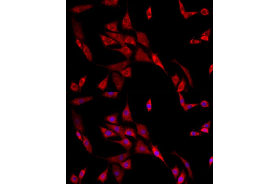 Immunofluorescence - Anti-beta 2 Adrenergic Receptor Antibody (A11507) - Antibodies.com