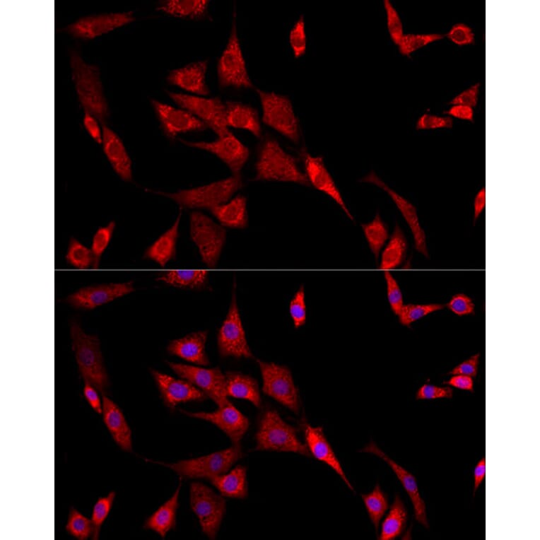 Immunofluorescence - Anti-beta 2 Adrenergic Receptor Antibody (A11507) - Antibodies.com