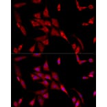 Immunofluorescence - Anti-beta 2 Adrenergic Receptor Antibody (A11507) - Antibodies.com