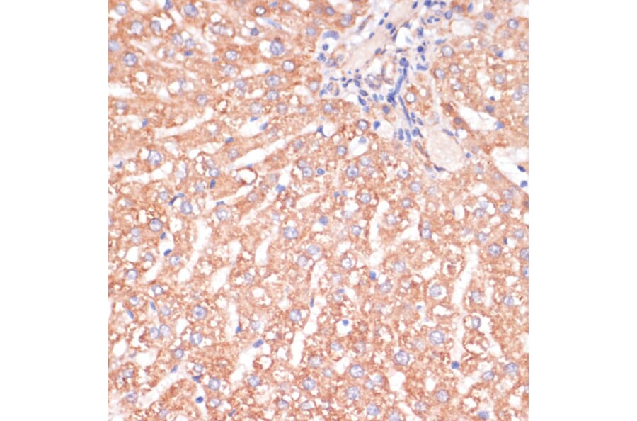 Immunohistochemistry - Anti-IKK alpha Antibody (A11508) - Antibodies.com