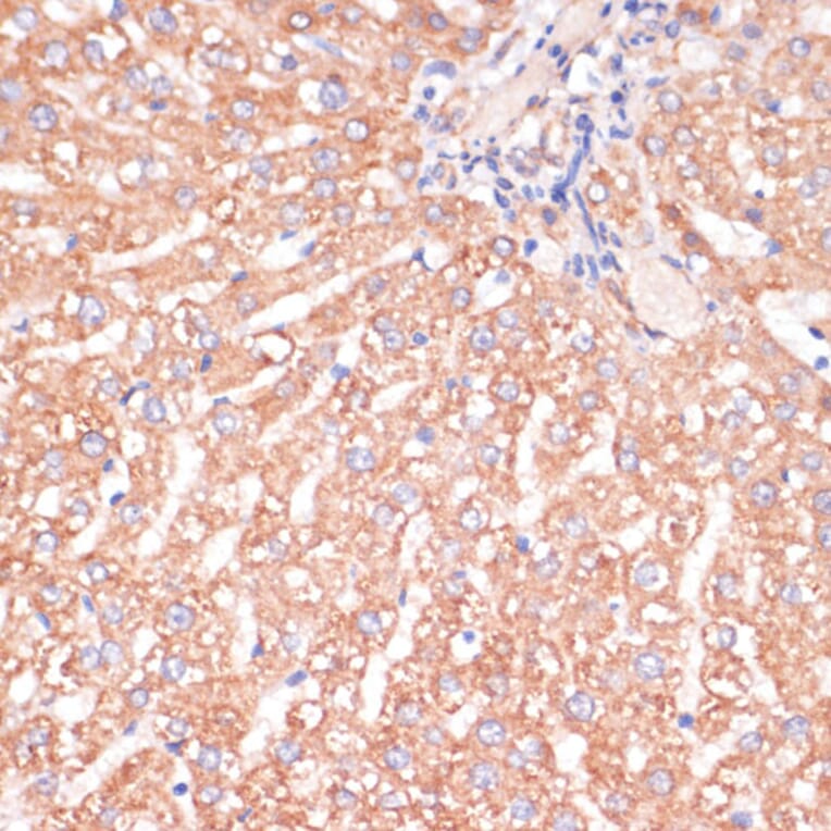 Immunohistochemistry - Anti-IKK alpha Antibody (A11508) - Antibodies.com