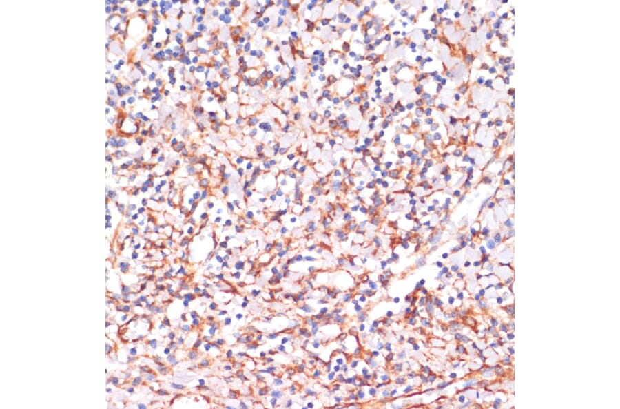 Immunohistochemistry - Anti-IKK alpha Antibody (A11508) - Antibodies.com