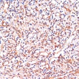 Immunohistochemistry - Anti-IKK alpha Antibody (A11508) - Antibodies.com