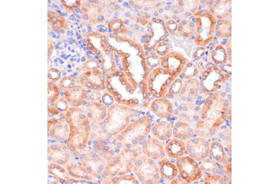 Immunohistochemistry - Anti-IKK alpha Antibody (A11508) - Antibodies.com