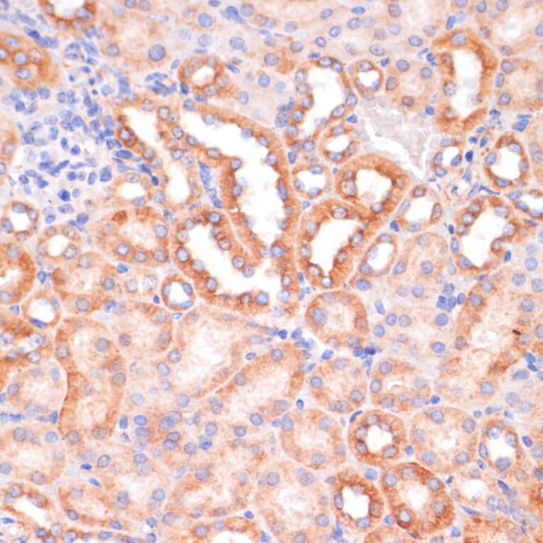 Immunohistochemistry - Anti-IKK alpha Antibody (A11508) - Antibodies.com