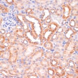 Immunohistochemistry - Anti-IKK alpha Antibody (A11508) - Antibodies.com