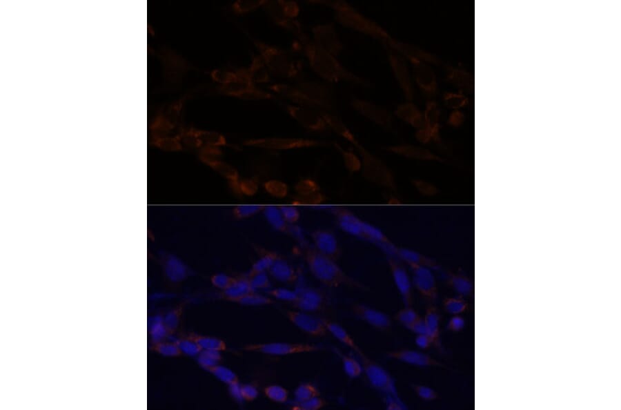 Immunofluorescence - Anti-IKK alpha Antibody (A11508) - Antibodies.com