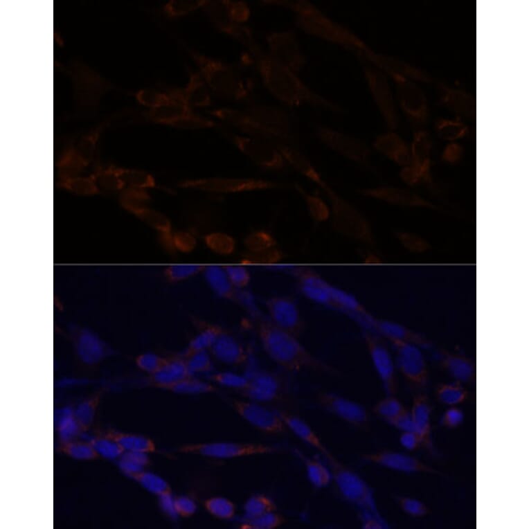 Immunofluorescence - Anti-IKK alpha Antibody (A11508) - Antibodies.com