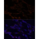 Immunofluorescence - Anti-IKK alpha Antibody (A11508) - Antibodies.com