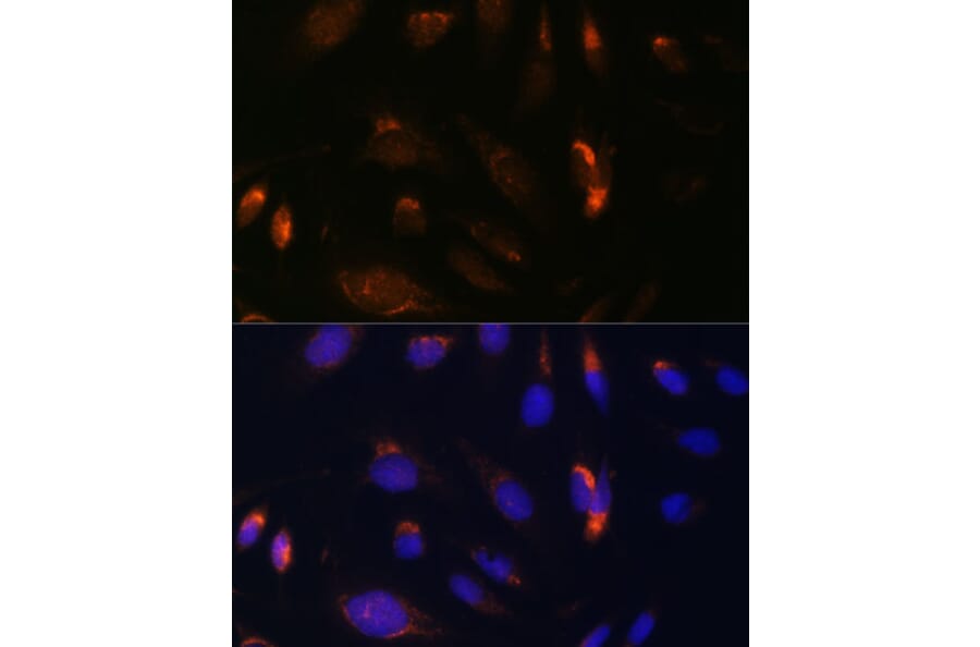 Immunofluorescence - Anti-IKK alpha Antibody (A11508) - Antibodies.com
