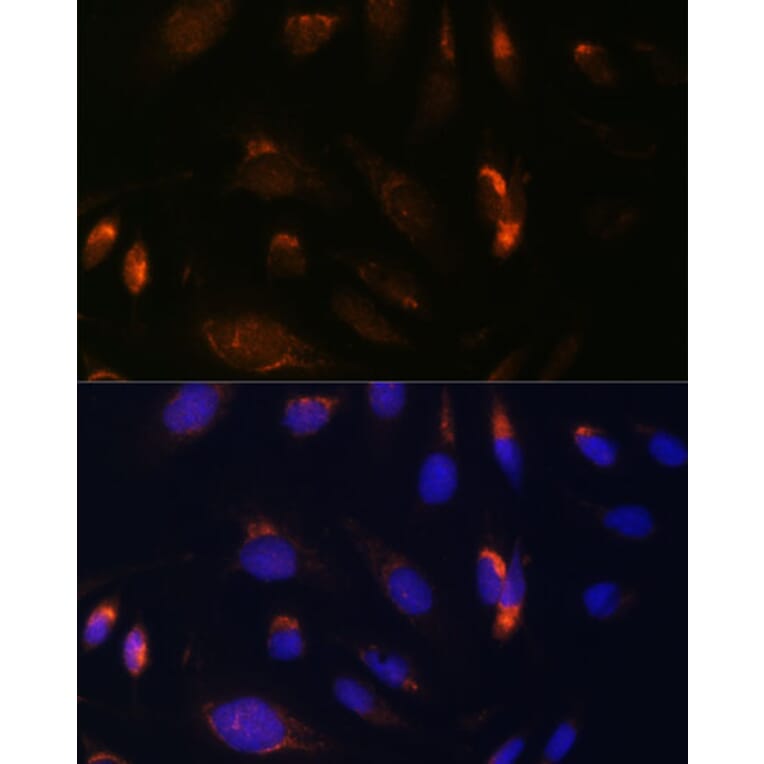 Immunofluorescence - Anti-IKK alpha Antibody (A11508) - Antibodies.com