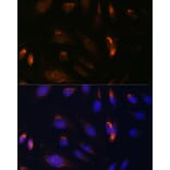 Immunofluorescence - Anti-IKK alpha Antibody (A11508) - Antibodies.com