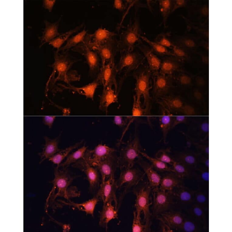 Immunofluorescence - Anti-E2F1 Antibody (A11509) - Antibodies.com