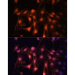 Immunofluorescence - Anti-E2F1 Antibody (A11509) - Antibodies.com