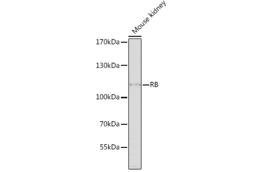 Western Blot - Anti-Rb Antibody (A11510) - Antibodies.com