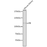 Western Blot - Anti-Rb Antibody (A11510) - Antibodies.com