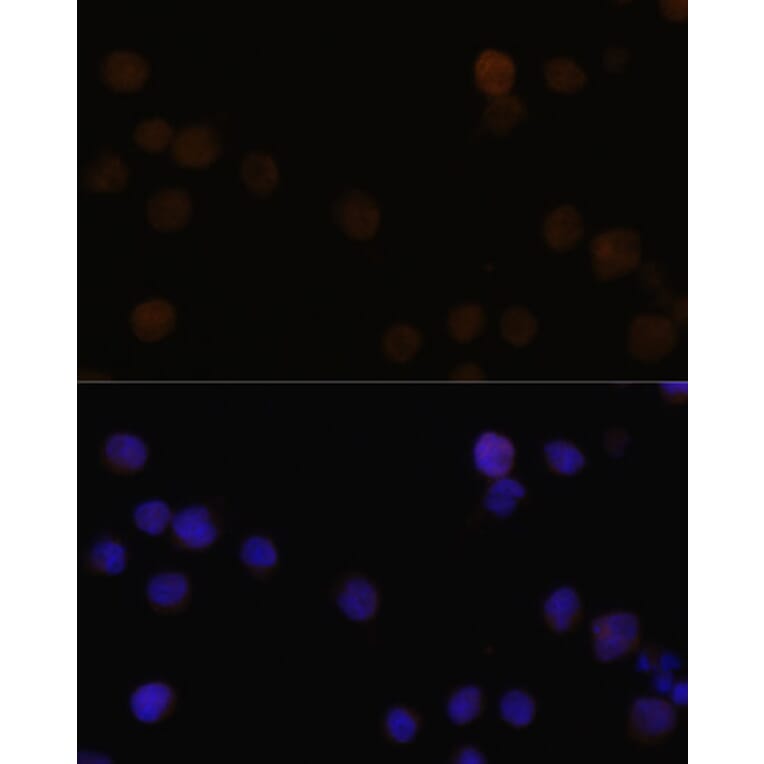 Immunofluorescence - Anti-Rb Antibody (A11510) - Antibodies.com