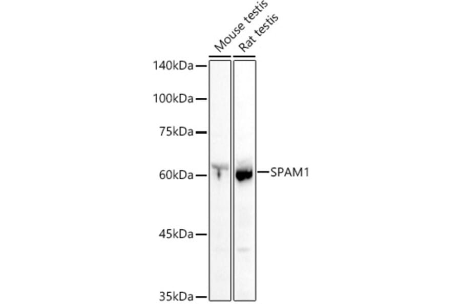 Western Blot - Anti-SPAM1 Antibody (A11511) - Antibodies.com