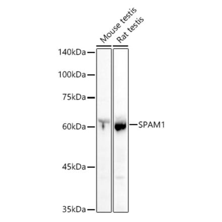Western Blot - Anti-SPAM1 Antibody (A11511) - Antibodies.com