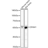 Western Blot - Anti-SPAM1 Antibody (A11511) - Antibodies.com