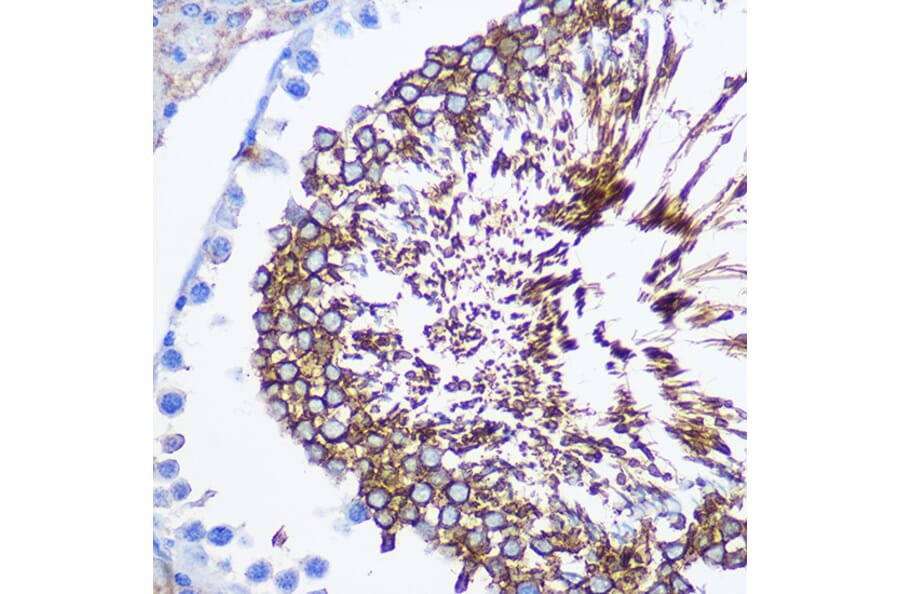 Immunohistochemistry - Anti-SPAM1 Antibody (A11511) - Antibodies.com