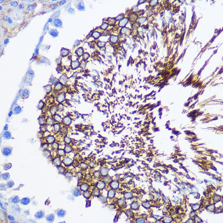 Immunohistochemistry - Anti-SPAM1 Antibody (A11511) - Antibodies.com