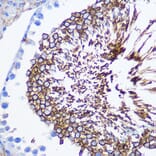 Immunohistochemistry - Anti-SPAM1 Antibody (A11511) - Antibodies.com