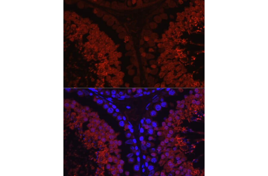 Immunofluorescence - Anti-SPAM1 Antibody (A11511) - Antibodies.com