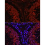 Immunofluorescence - Anti-SPAM1 Antibody (A11511) - Antibodies.com