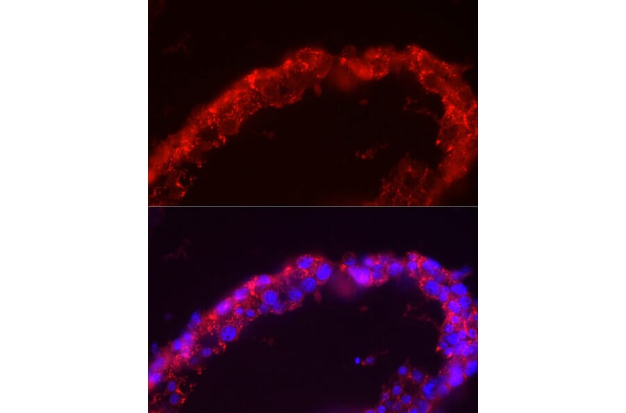 Immunofluorescence - Anti-SPAM1 Antibody (A11511) - Antibodies.com