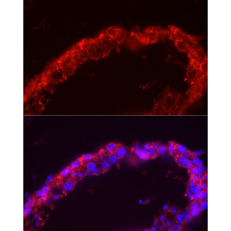 Immunofluorescence - Anti-SPAM1 Antibody (A11511) - Antibodies.com