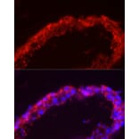 Immunofluorescence - Anti-SPAM1 Antibody (A11511) - Antibodies.com