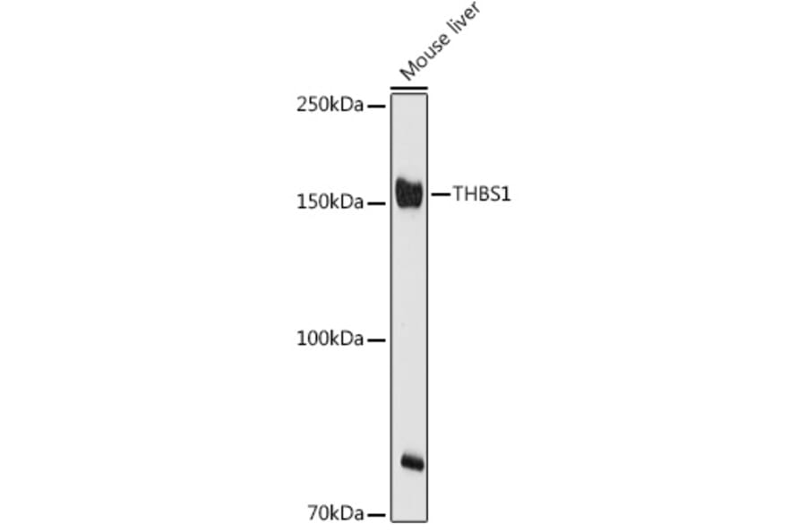 Western Blot - Anti-Thrombospondin 1 Antibody (A11512) - Antibodies.com