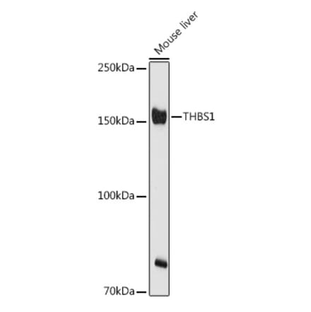 Western Blot - Anti-Thrombospondin 1 Antibody (A11512) - Antibodies.com
