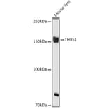 Western Blot - Anti-Thrombospondin 1 Antibody (A11512) - Antibodies.com