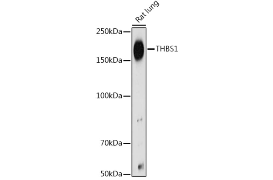 Western Blot - Anti-Thrombospondin 1 Antibody (A11512) - Antibodies.com