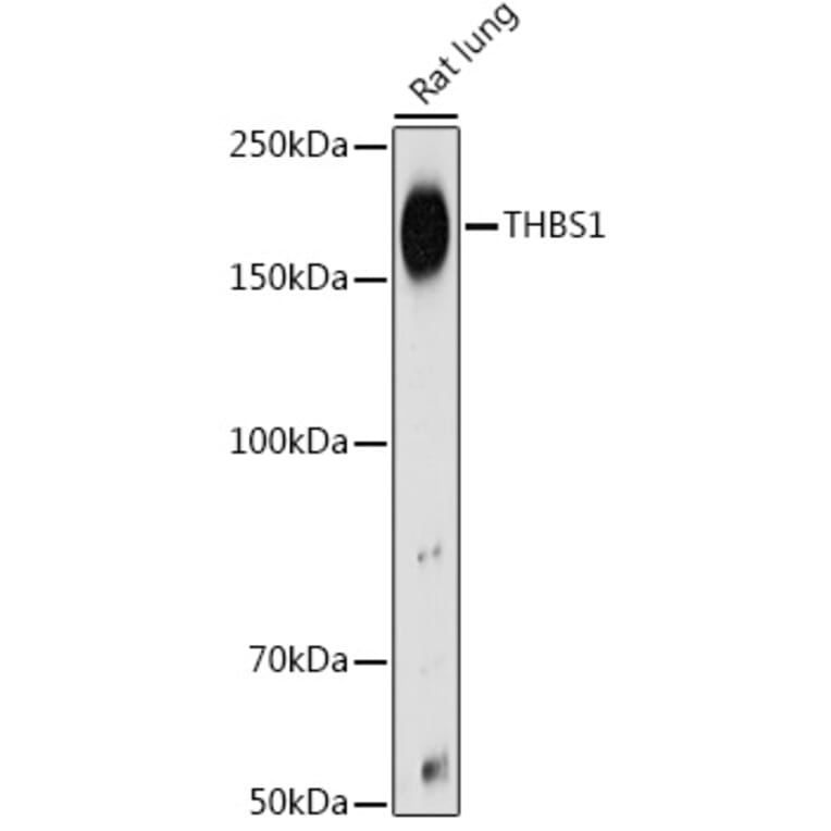 Western Blot - Anti-Thrombospondin 1 Antibody (A11512) - Antibodies.com