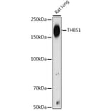 Western Blot - Anti-Thrombospondin 1 Antibody (A11512) - Antibodies.com