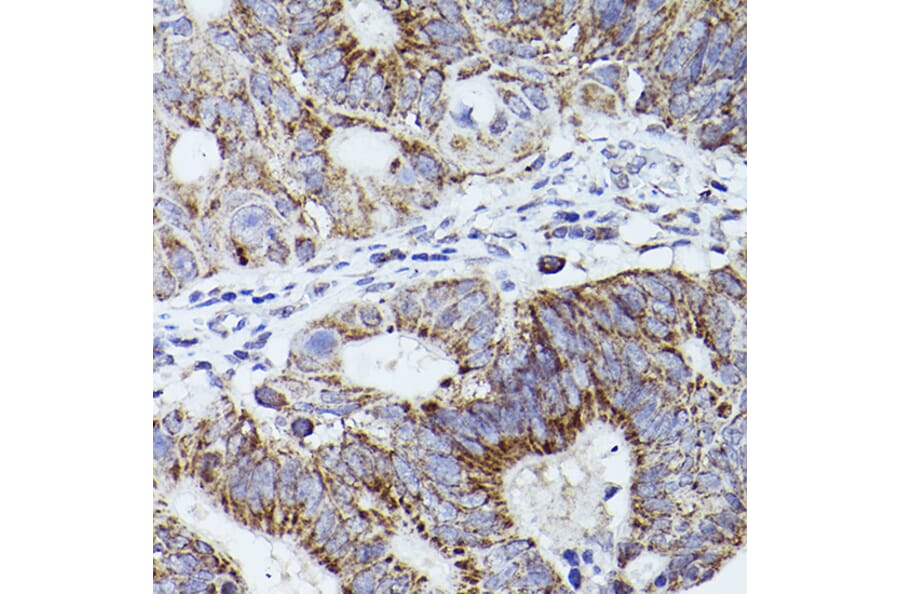 Immunohistochemistry - Anti-Thrombospondin 1 Antibody (A11512) - Antibodies.com