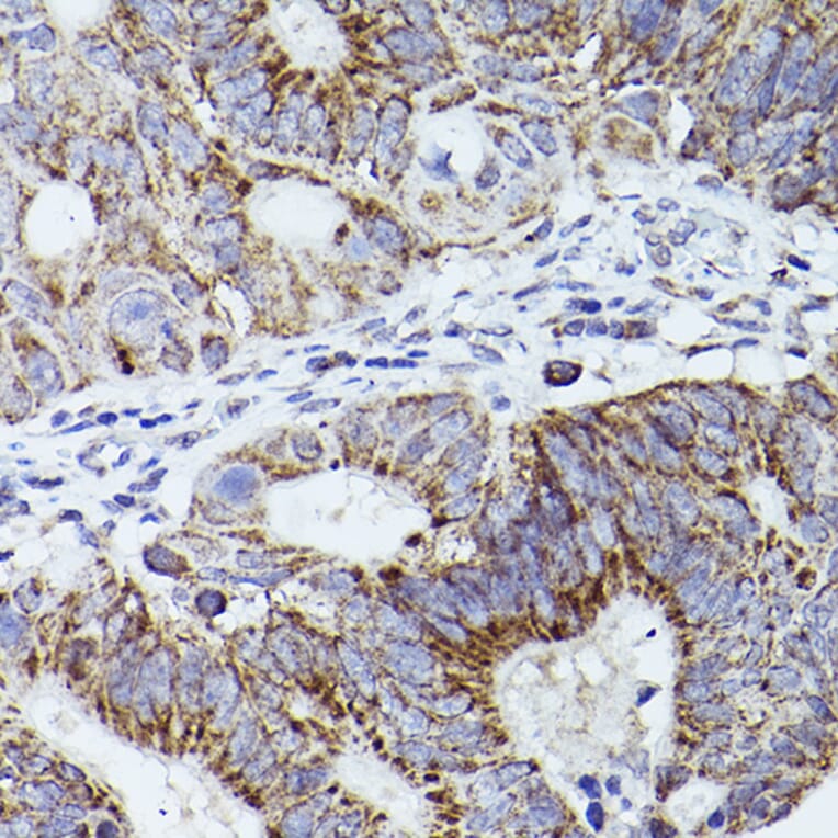 Immunohistochemistry - Anti-Thrombospondin 1 Antibody (A11512) - Antibodies.com