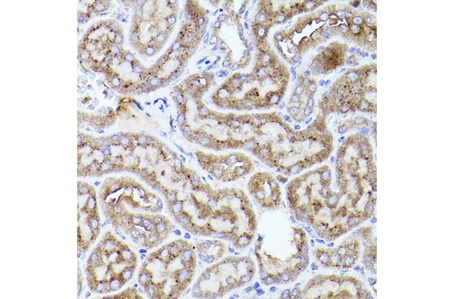 Immunohistochemistry - Anti-Thrombospondin 1 Antibody (A11512) - Antibodies.com