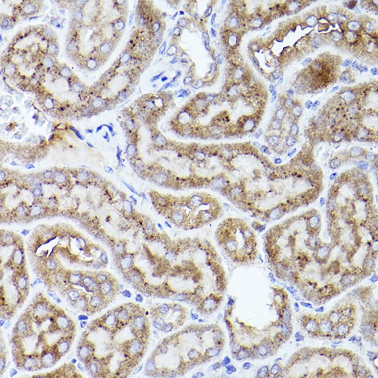 Immunohistochemistry - Anti-Thrombospondin 1 Antibody (A11512) - Antibodies.com