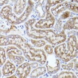 Immunohistochemistry - Anti-Thrombospondin 1 Antibody (A11512) - Antibodies.com