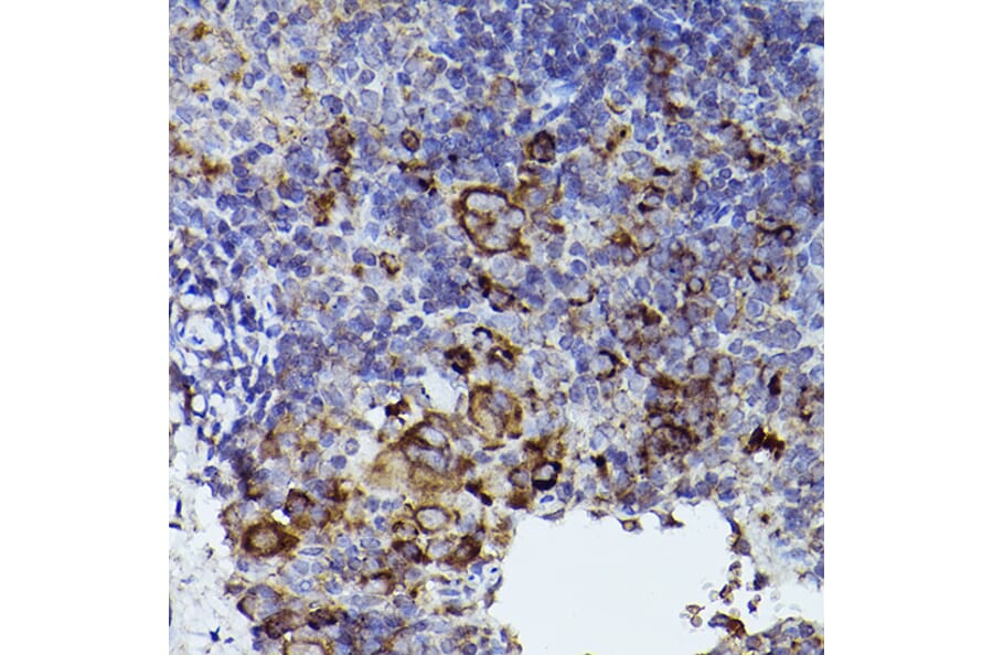 Immunohistochemistry - Anti-Thrombospondin 1 Antibody (A11512) - Antibodies.com