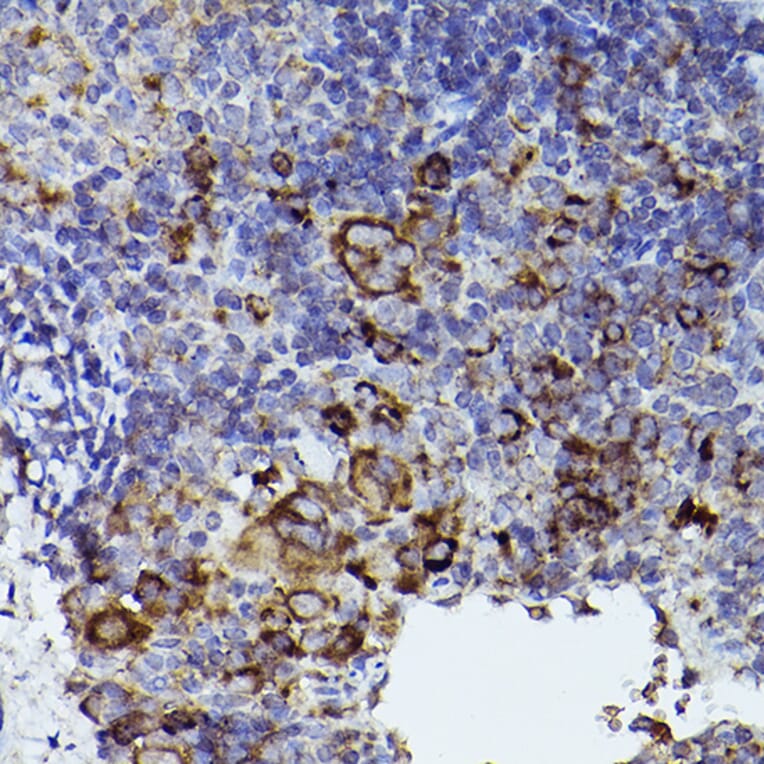 Immunohistochemistry - Anti-Thrombospondin 1 Antibody (A11512) - Antibodies.com