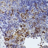 Immunohistochemistry - Anti-Thrombospondin 1 Antibody (A11512) - Antibodies.com