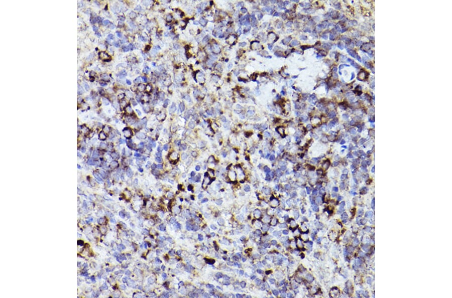 Immunohistochemistry - Anti-Thrombospondin 1 Antibody (A11512) - Antibodies.com