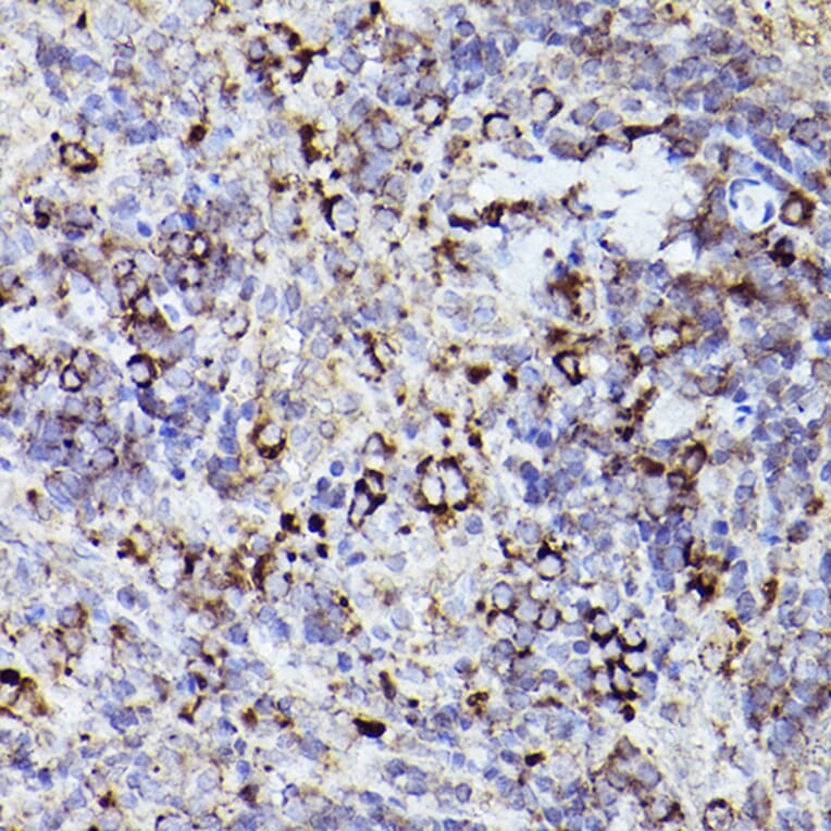 Immunohistochemistry - Anti-Thrombospondin 1 Antibody (A11512) - Antibodies.com